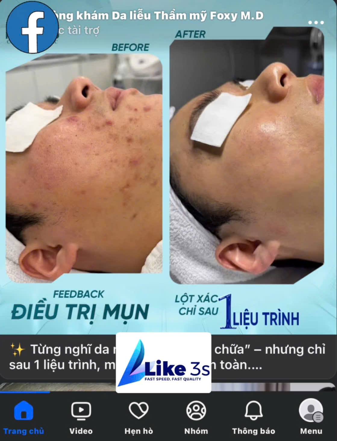 facebook-ads-khong-duoc-duyet-nguyen-nhan-va-cach-khac-phuc-nhanh-chong-hieu-qua